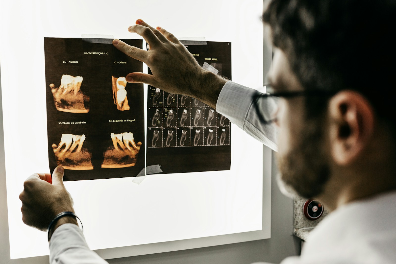 3D rekonstrüksiyon ve kesit analizi